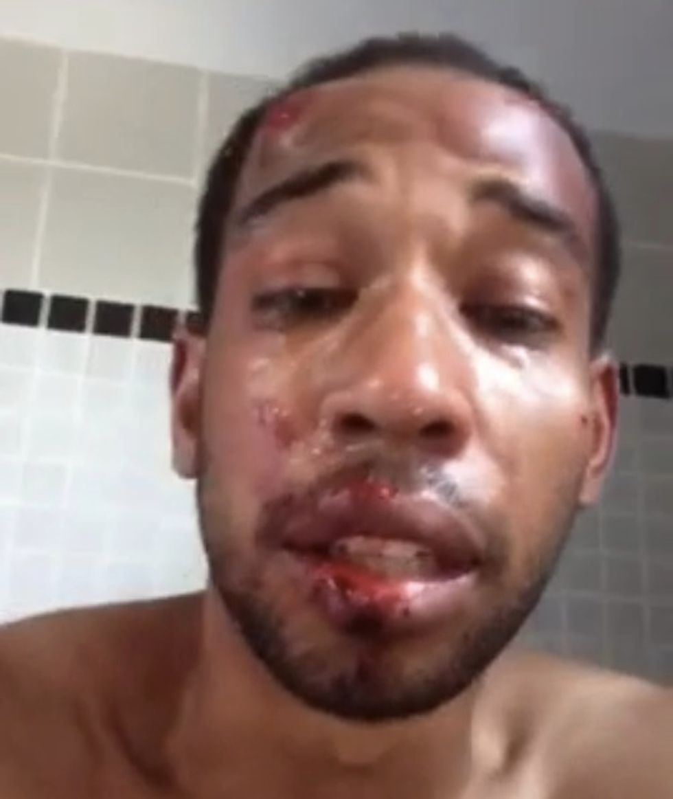 Viewers Moved by Bloody and Bruised Man's Viral Video Describing Huge Struggles to Better His Community